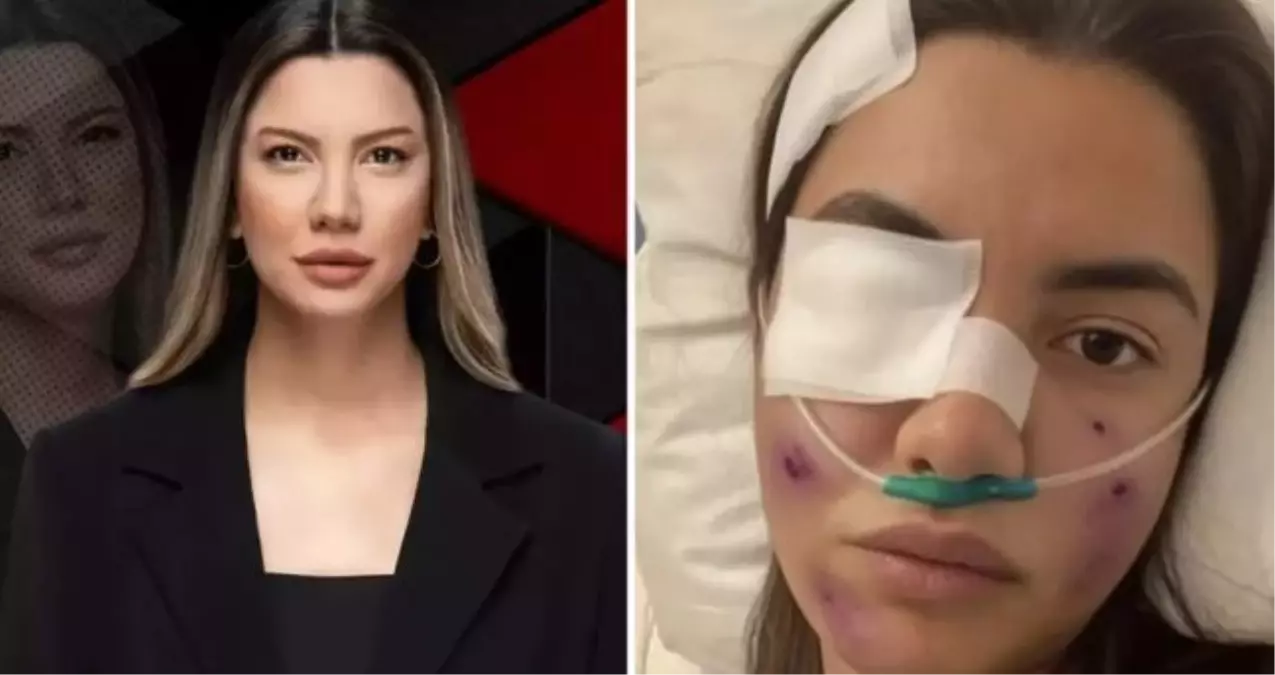 Fulya Öztürk trafik kazası mı geçirdi, görüntüler yapay zeka ile mi yapıldı? Fulya Öztürk ne açıklama yaptı?