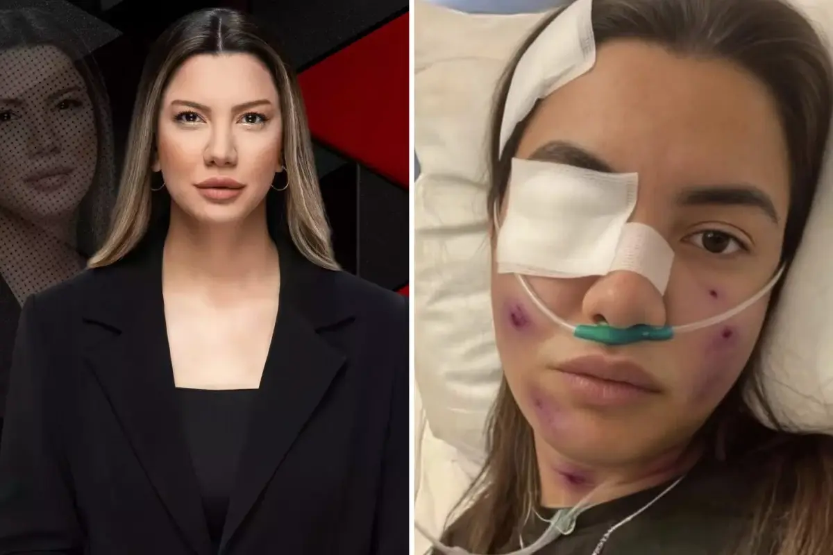 Fulya Öztürk trafik kazası mı geçirdi? Sosyal medyada yayılan o fotoğrafın gerçek yüzü ortaya çıktı!