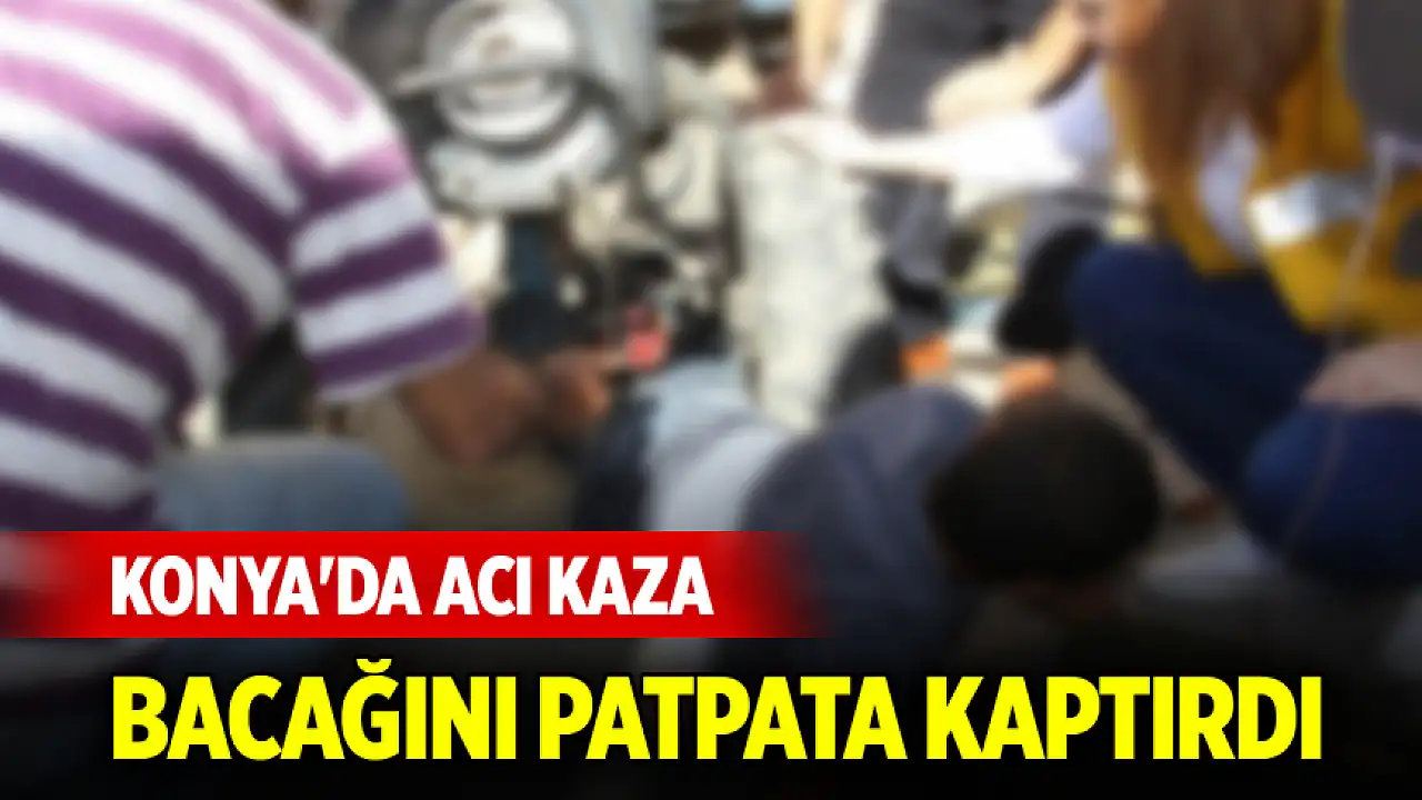Konya'da acı kaza: Bacağını patpata kaptırdı